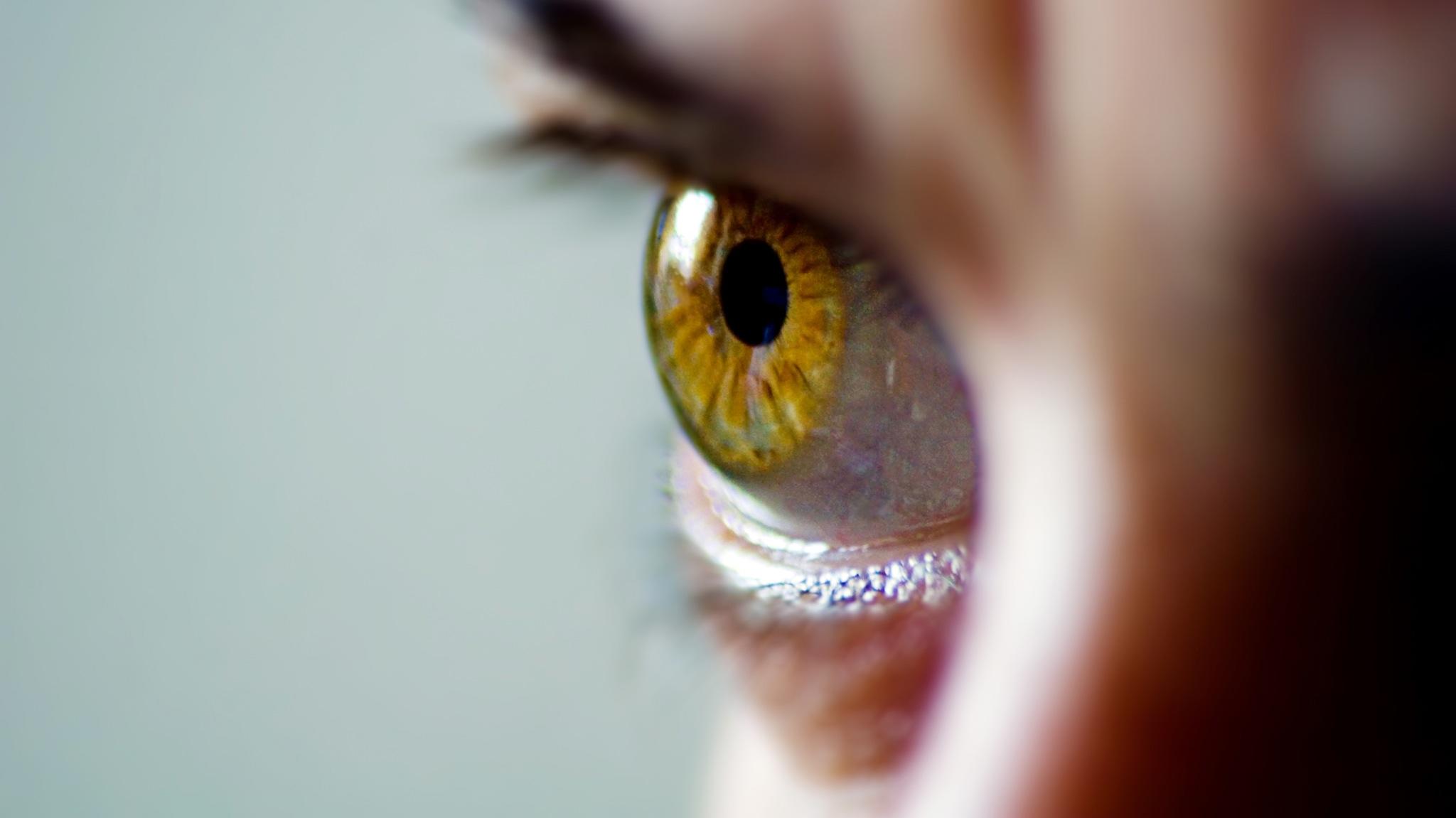 Iris